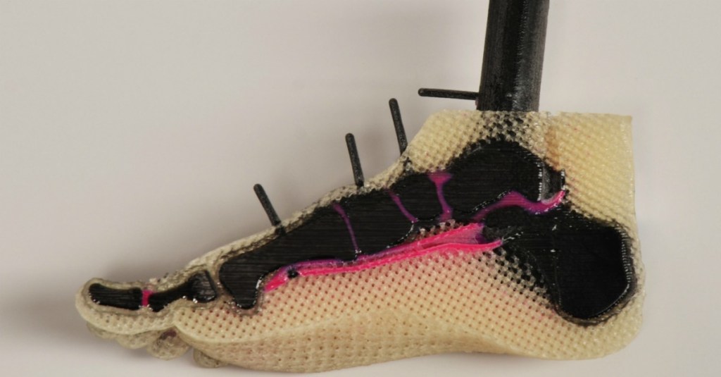 How 3D printers are cutting down surgery times and helping vets get mobility back at VA hospitals