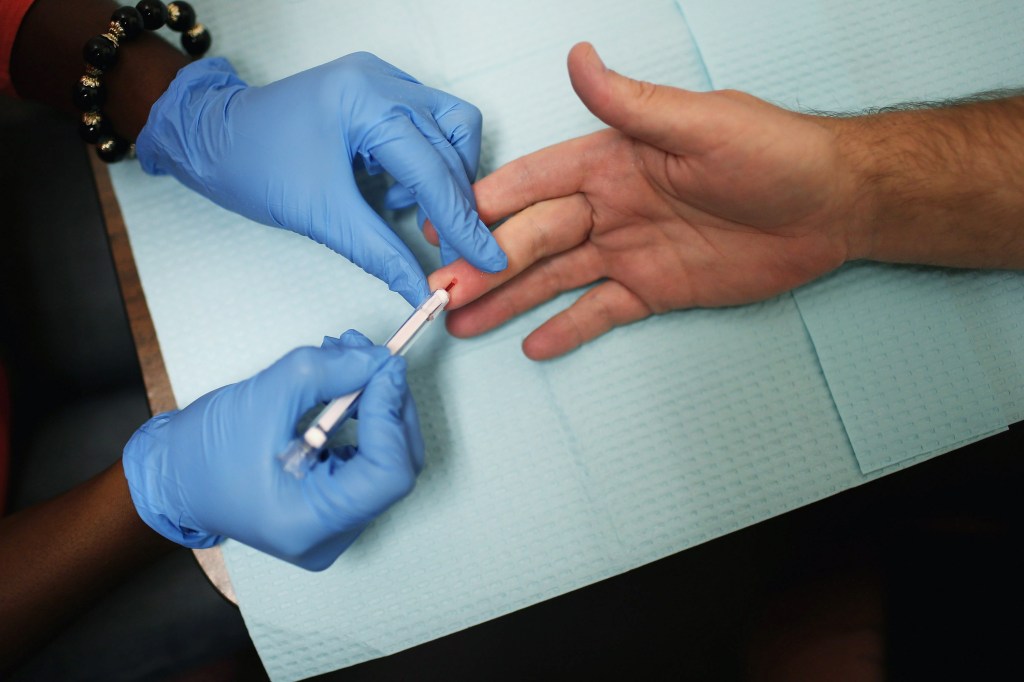 New policy keeps HIV-positive troops deployable, bars involuntary separation in some cases