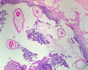 Army refutes claims of massive parasite outbreak at Fort Knox